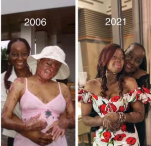 “We’ve come such a long way” – Kechi Okwuchi shares photo taken one year after surviving Sosoliso plane crash as she celebrates her mother